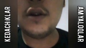 #Ам йалоклар #zapal #amyaloqlar #fohisha  #soskalar #Tungiret   #tiktokamlari #запаллар #запал