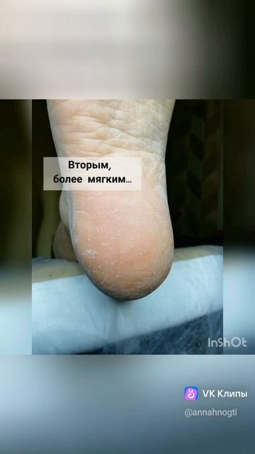 Smart педикюр смотреть онлайн