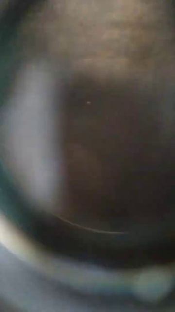 scabies microscope смотреть онлайн