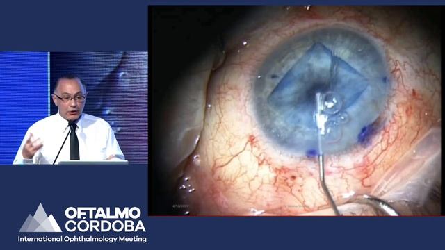 Dr Néstor Szuster - 2019 смотреть онлайн