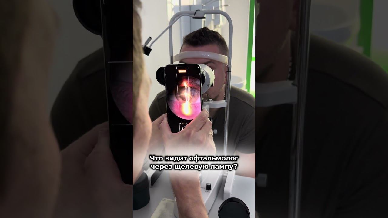 Загляните в щелевую лампу глазами доктора #здоровьеглаз #зрение #щелеваялампа #офтальмолог #глаза смотреть онлайн