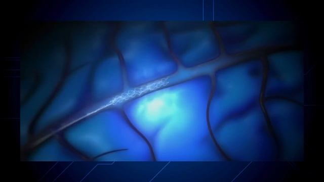 Neuralink News: First Patient Update смотреть онлайн