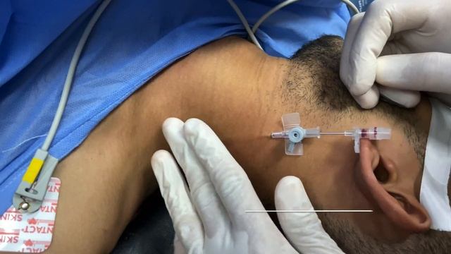 External Jugular Vein Cannulation смотреть онлайн