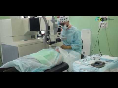 Как проходит ЛАСИК? смотреть онлайн