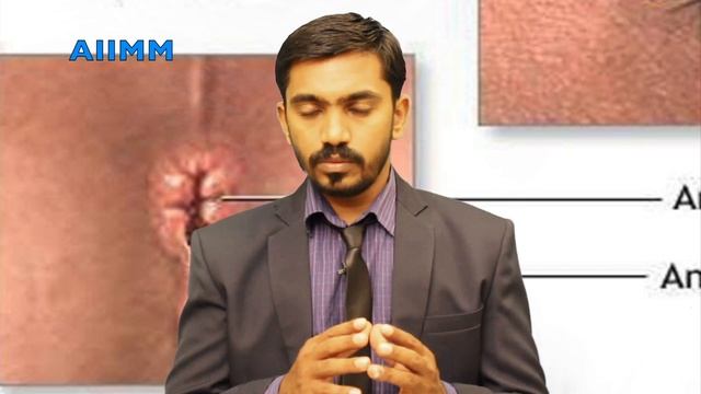 மூலம் l ஆசனவாய் வெடிப்பு l காரணம் l தீர்வு l மலவாய் பராமரிப்பு l Piles treatment l DrSj l смотреть онлайн