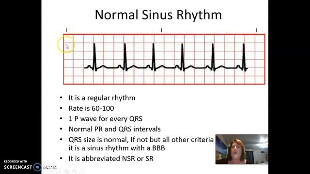 Sinus Rhythms