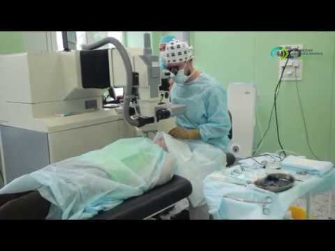 Лазерная коррекция зрения - это больно? смотреть онлайн
