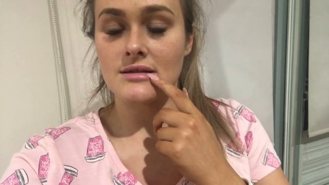 Getting Lip Fillers | Laser Clinic Australia смотреть онлайн