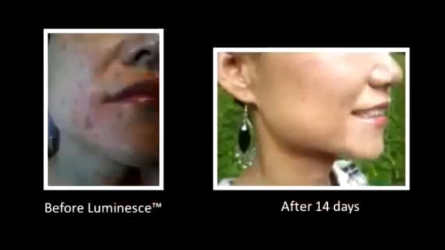 Омоложение лица и кожи. Продукция Jeunesse. БОМБА!