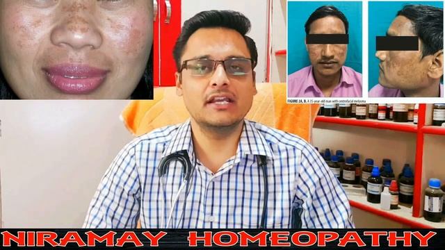 melasma treatment/ jhaiyon ka ilaj / hyper pigmentation / dark spots /how to remove pigmentation смотреть онлайн