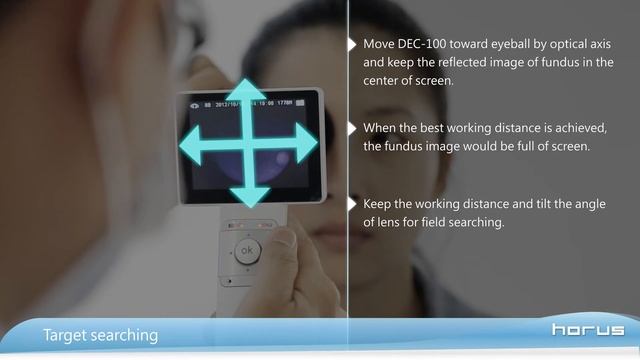 Horus Digital Non-mydriatic Eye-fundus Camera │ MiiS