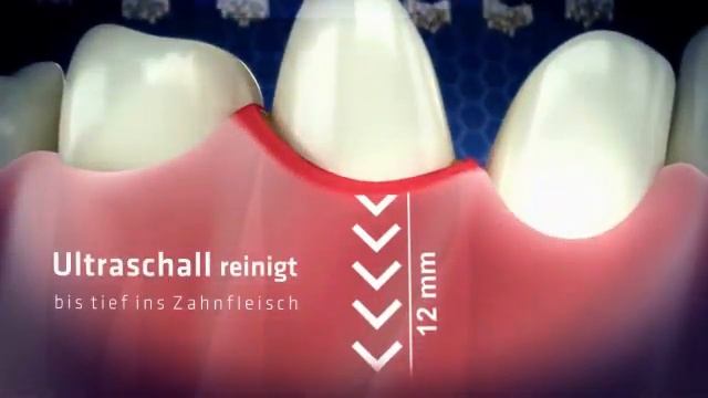 Was Zahnärzte gerne verschweigen смотреть онлайн