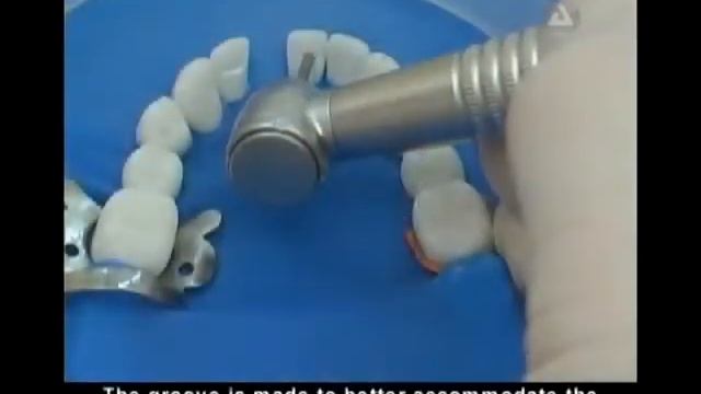 Обзор Angelus Interlig смотреть онлайн