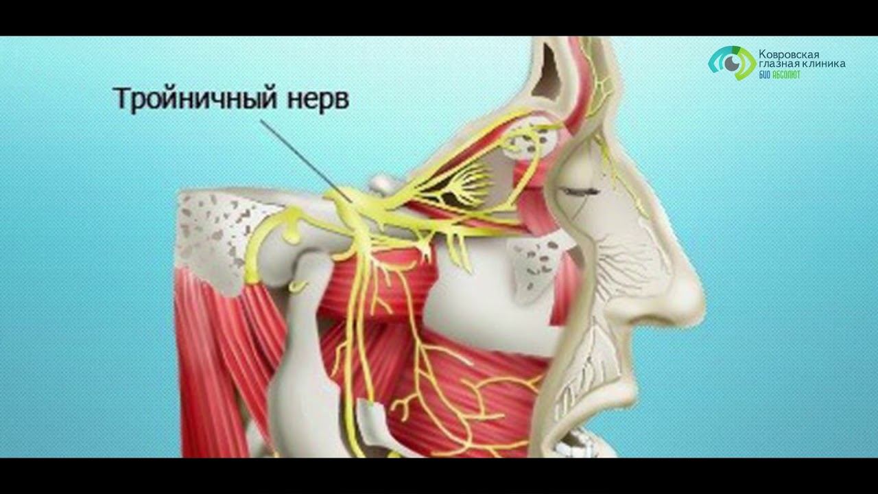 Воспаление тройничного нерва смотреть онлайн