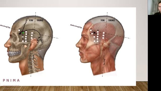 ZS YNSA point for effect on Parkinson's disease. смотреть онлайн