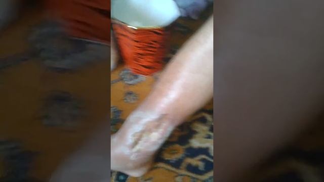 Сломаная нога. Жесть смотреть всем смотреть онлайн