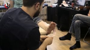 Неврома Мортона. Лечение при помощи УВТ. Методика Ударно-волновой терапии при невроме Мортона