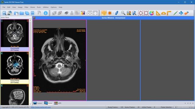 Sante DICOM Viewer - How to compare images of different series смотреть онлайн