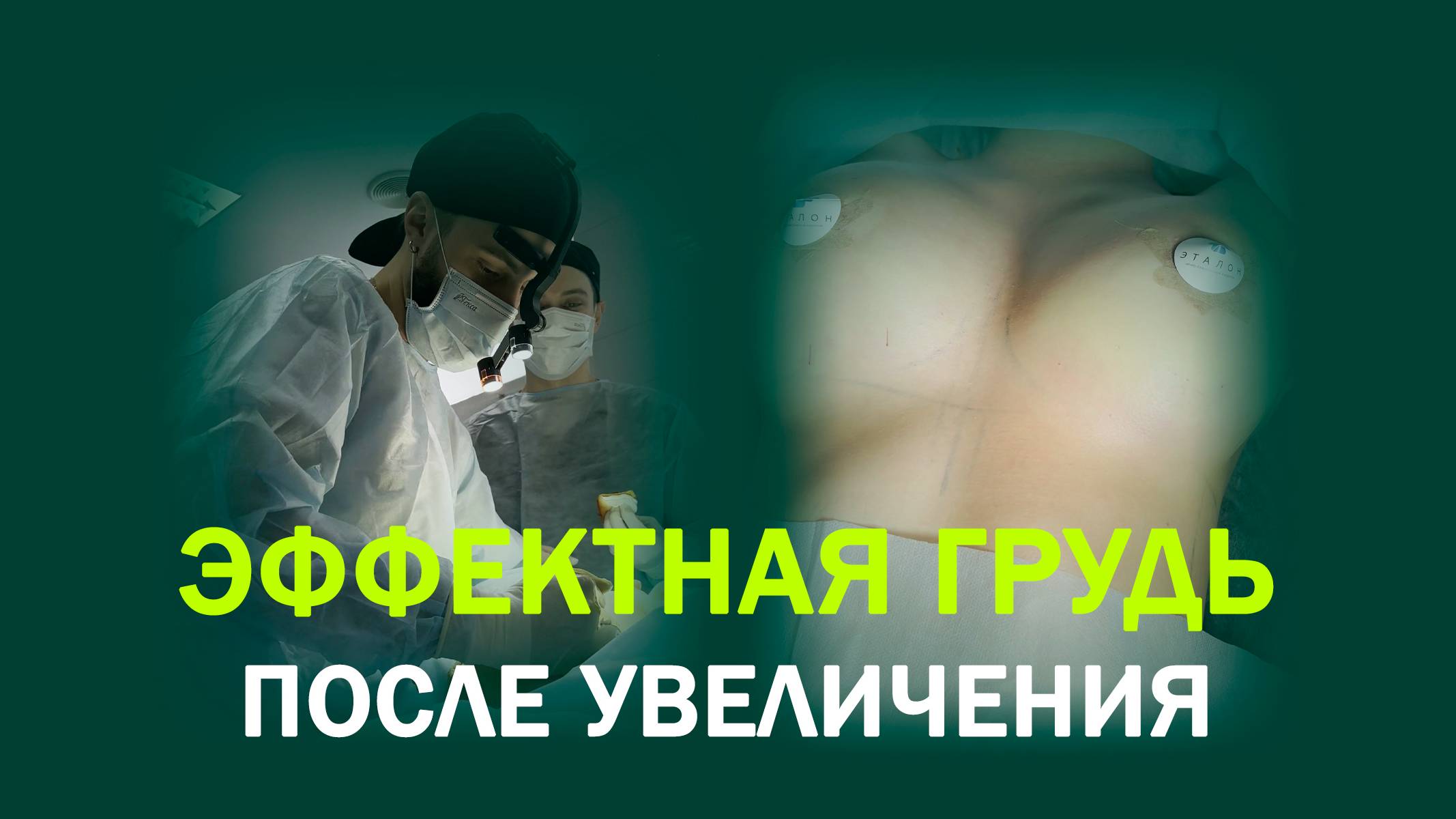 Увеличение груди у доктора Волкова: результат уже на операционном столе смотреть онлайн