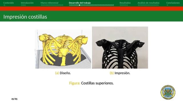 UdeNar - Sustentación Trabajo De Grado:Medición De La Dosis Equivalente En órganos Torácicos ...