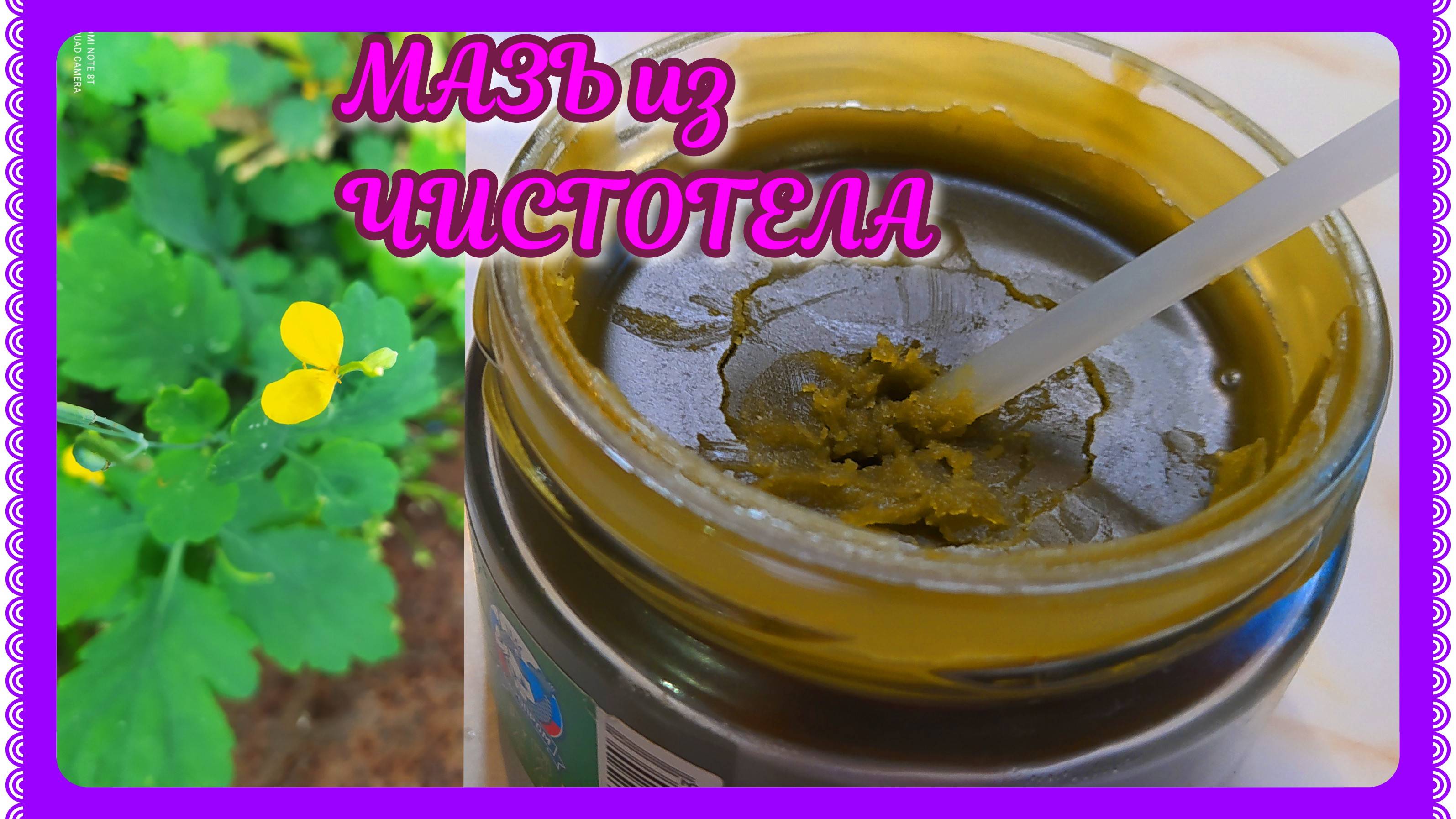 МАЗЬ из ЧИСТОТЕЛА! Убираем папилломы ,бородавки ,грибок! Майская мазь самая эффективная! смотреть онлайн