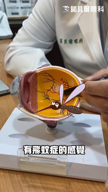 #找醫師抓蚊子 #飛蚊症 смотреть онлайн