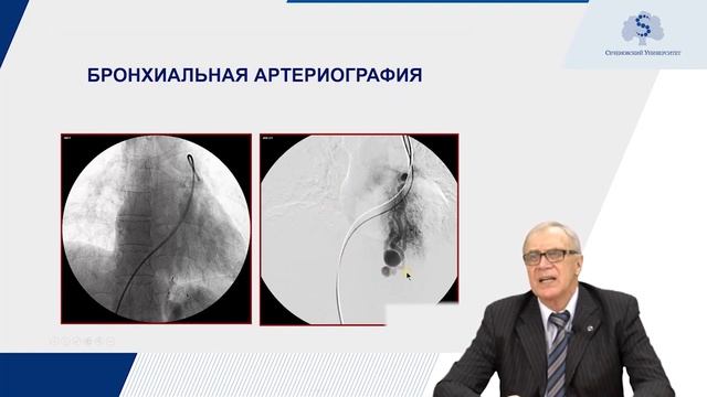 8 Неотложные состояния во фтизиопульмонологии смотреть онлайн