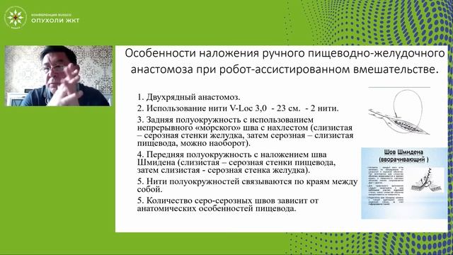 Робот-ассистированная пластика пищевода по Ivor-Lewis смотреть онлайн