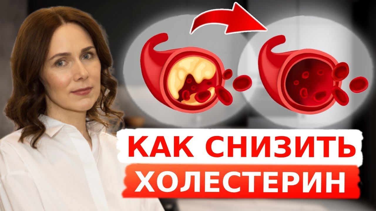 Снижаем ХОЛЕСТЕРИН без лекарств | ВСЯ ПРАВДА о холестерине смотреть онлайн