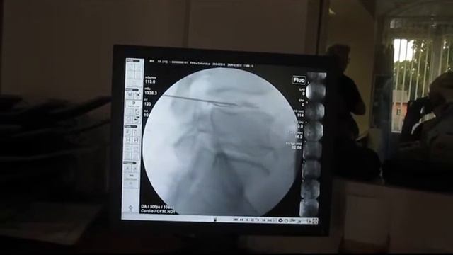Дискогель Молдова смотреть онлайн