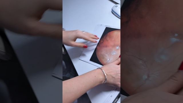 ✨ Заглянем в лазерный кабинет вместе? смотреть онлайн