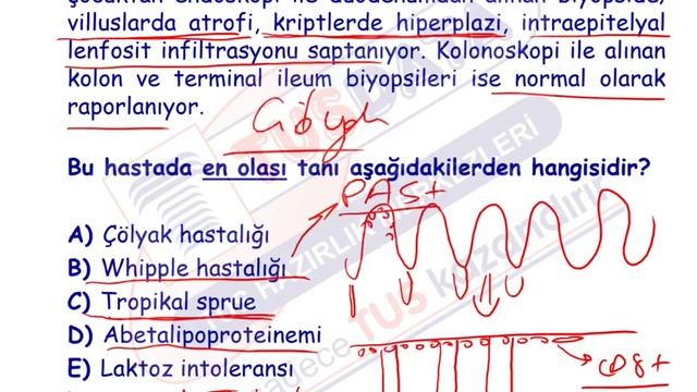 Mega Paket Patoloji | Vaka Soru Çözümleri - 2 смотреть онлайн