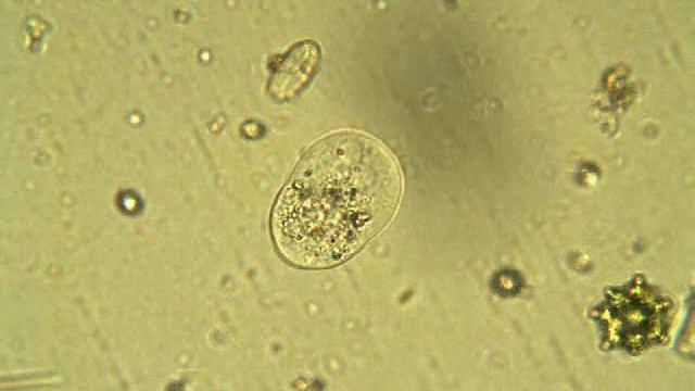 Vahlkampfia смотреть онлайн