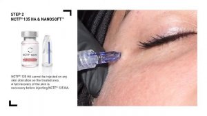 FILLMED   Eye Injection with NCTF 135 HA
