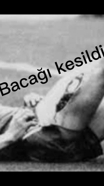 En kötü sakatlanan futbolcular part 2 #petrcech #salah #E.lienen￼ смотреть онлайн
