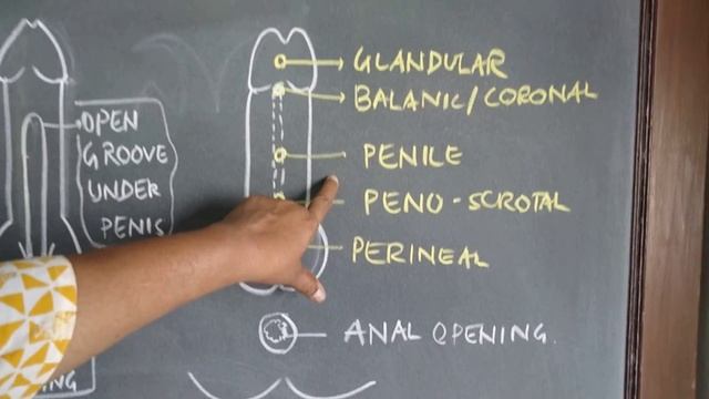 Development of external genitalia (part-02) смотреть онлайн
