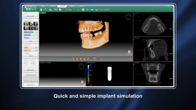 Vatech Ez3D i Introduction Video смотреть онлайн