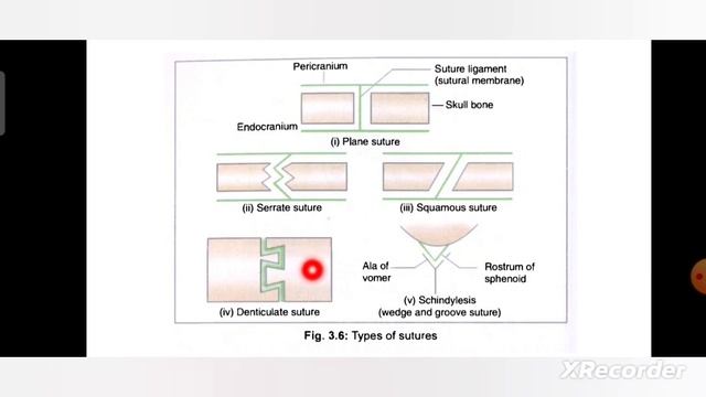 JOINTS ANATOMY-II by Dr. Ravina Kalyan| Physiotherapy| RPIIT| смотреть онлайн