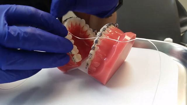 Powerscope Video - Humbertown Orthodontics смотреть онлайн