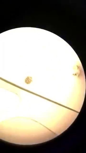 Scabies - Veterinary Video смотреть онлайн