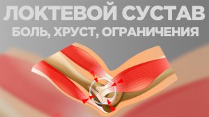 Упражнения от боли в локте. ЛФК при эпикондилите и травме локтевого сустава.