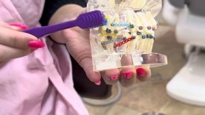 Как чистить зубы правильно с брекетами правильная мягкая зубная щётка Краснодар стоматология брекет