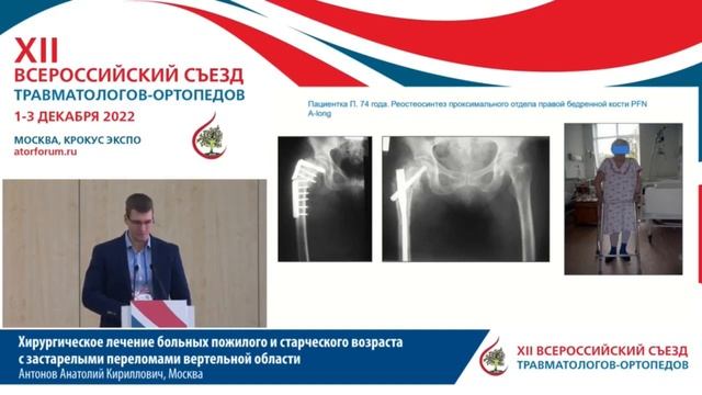 Хирургическое лечение больных пожилого и старческого возраста с застарелыми переломами вертельной о смотреть онлайн