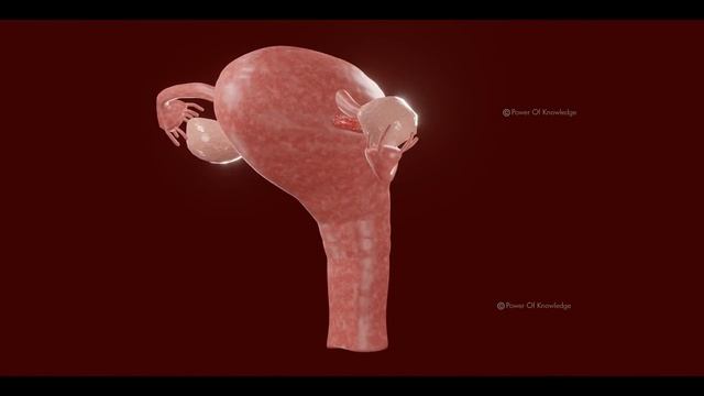 What Causes Ovarian Torsion? | Symptoms, Causes And Treatment (3D Animation) смотреть онлайн