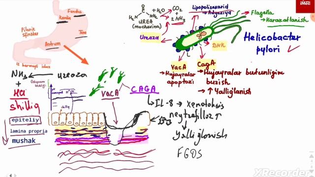 Oshqozon Va O'n Ikki Barmoqli Ichak Yara Kasalligi