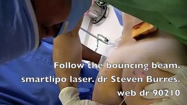 laser butt, cellulite cure, light up your butt, Dr Steven Burres, web dr 90210, 1-877-784-5543 смотреть онлайн