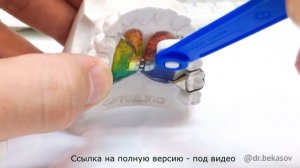 Ортодонтический аппарат Haas/ Марко – Росса. Оrthodontic appliance.