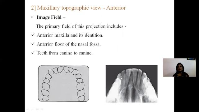 OCCLUSAL RADIOGRAPHY | DR APEKSHA DHOLE смотреть онлайн