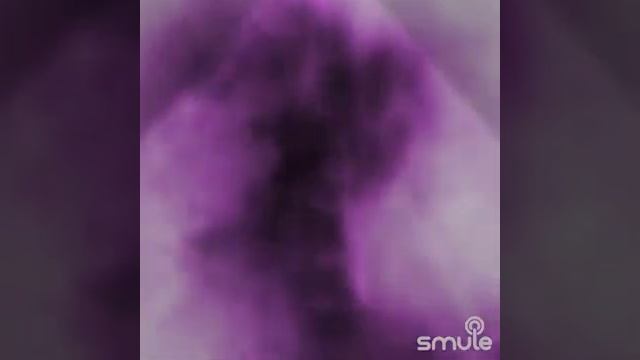 Bana öyle bakma смотреть онлайн