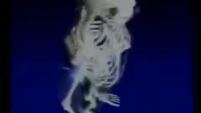 Остеопороз и Подагра Лечение Щелочной ионизированной водой смотреть онлайн